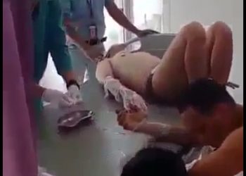 8 Pekerja OKI Pulp Dilarikan ke RS Charitas