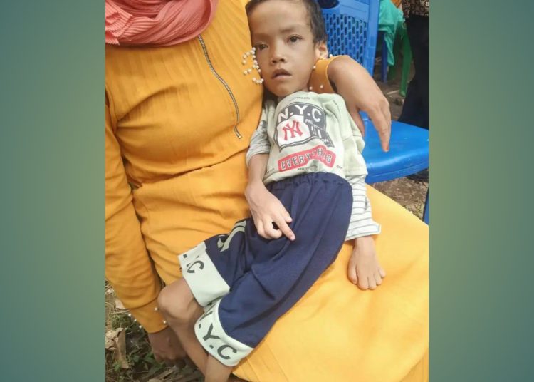 Kondisi Tubuh Memprihatinkan, Mario Butuh Bantuan dan Uluran Tangan dari Pemerintah dan Dermawan